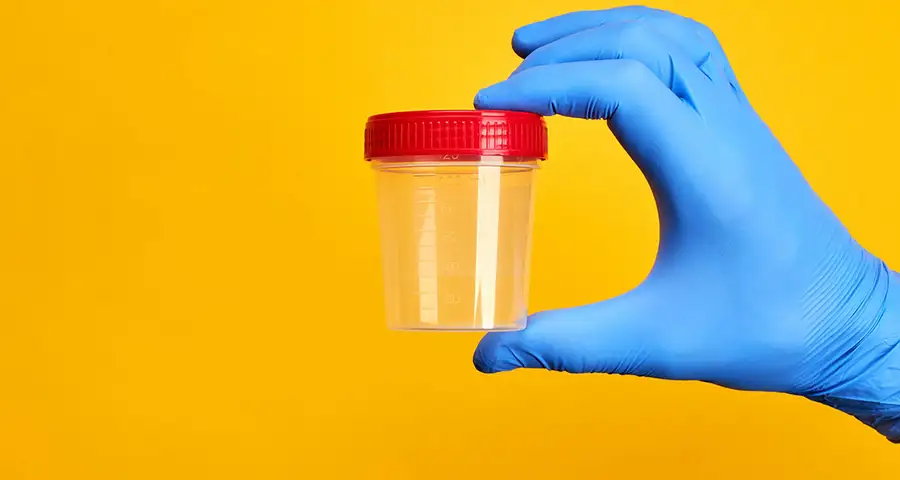 Who Does Drug Test